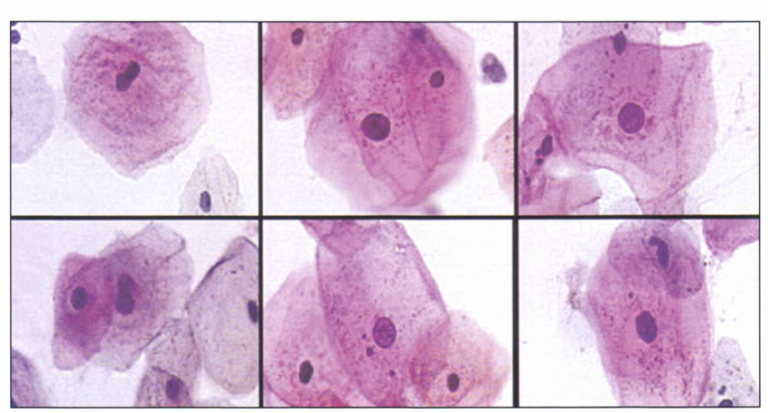 Artificial Intelligence and Machine Learning (AI/ML) in Medical Devices